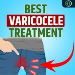 varicocele treatment without surgery