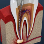 Dantah Dental The Best Dental Clinic in Gangapur Road, Nashik