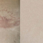 Elliot’s Carpet Cleaning – Chelmsford