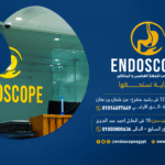 تعرف علي أبرز أسباب ومضاعفات عسر الهضم بعد استئصال المرارة